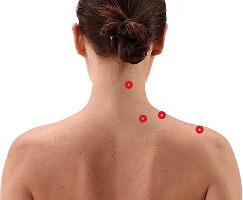 patch-crosstape-points-acupuncture
